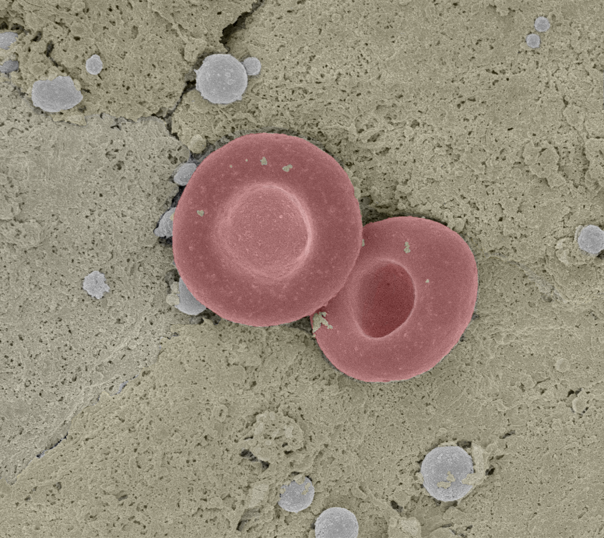 A scanning electron micrograph of red blood cell in a mouse liver.