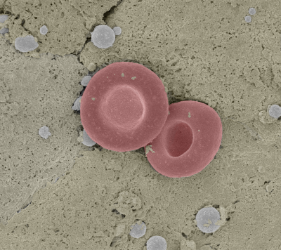 A scanning electron micrograph of red blood cell in a mouse liver.