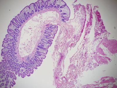 Normal colon stained with Hematoxylin and Eosin